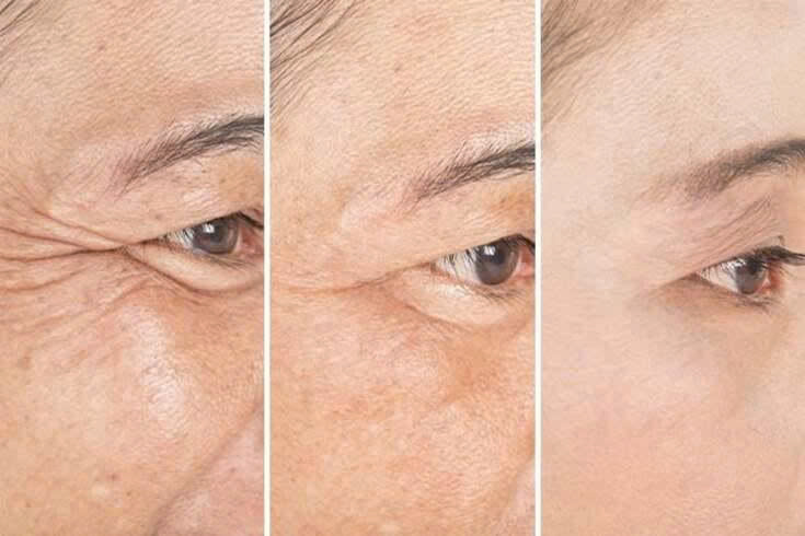 nuoc-uong-collagen-kenkogen-1.jpg